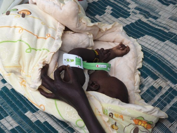 GOAL Develops Screening Tool to Detect Malnutrition in Babies Under 6