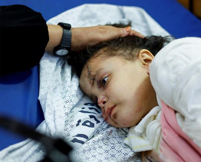 Gaza-child-patient